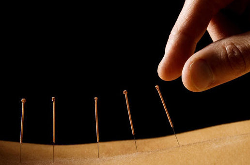 A Patient's Guide to Chinese Medicine